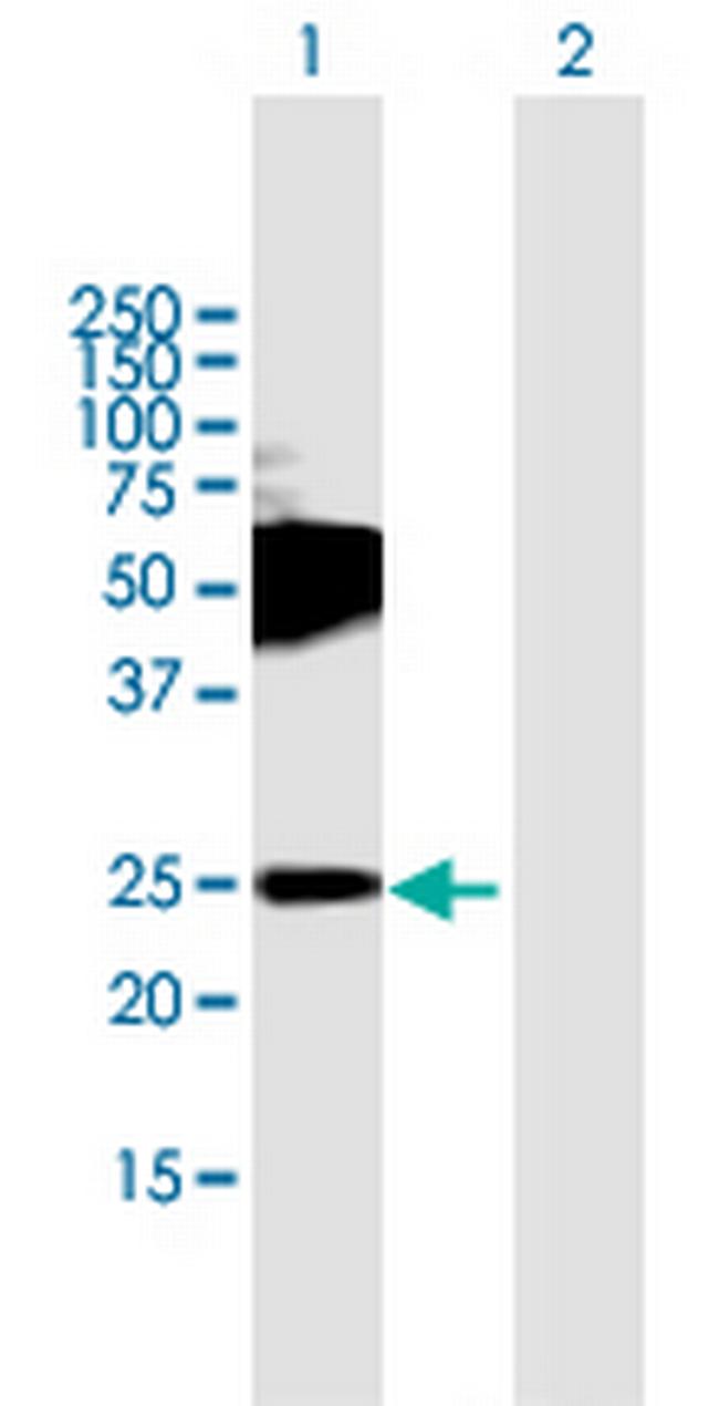TMEM123 Antibody in Western Blot (WB)