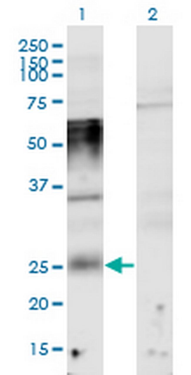 TMEM123 Antibody in Western Blot (WB)