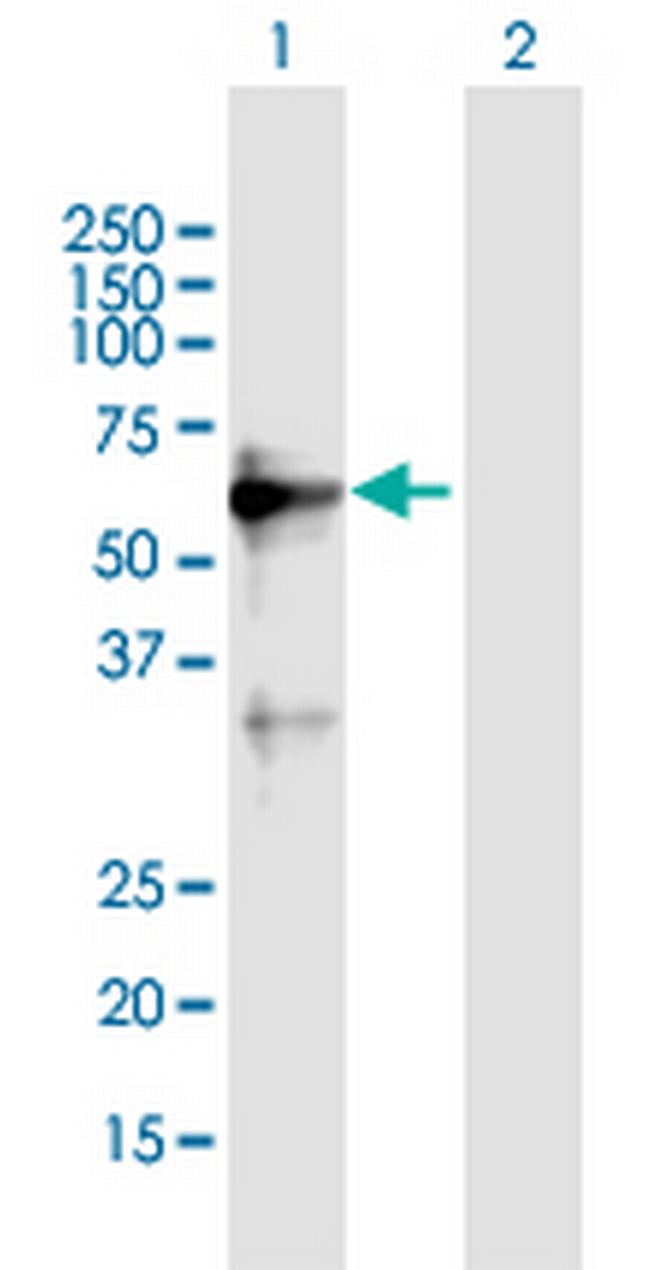 ZNF554 Antibody in Western Blot (WB)