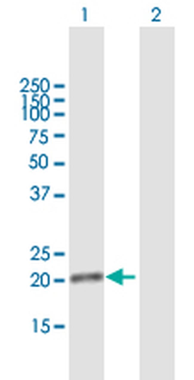 DDIT4L Antibody in Western Blot (WB)