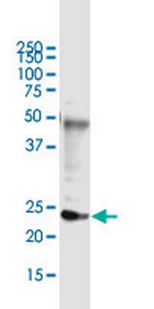 DDIT4L Antibody in Immunoprecipitation (IP)