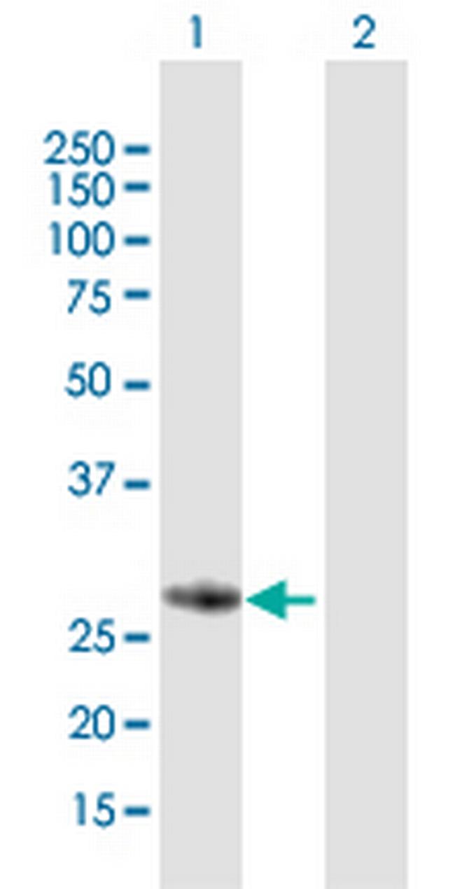 FBXO17 Antibody in Western Blot (WB)