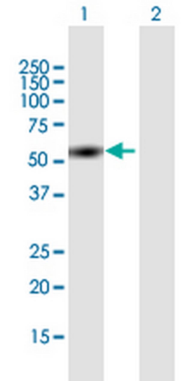ZNF689 Antibody in Western Blot (WB)