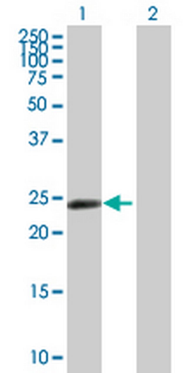 ZNF501 Antibody in Western Blot (WB)