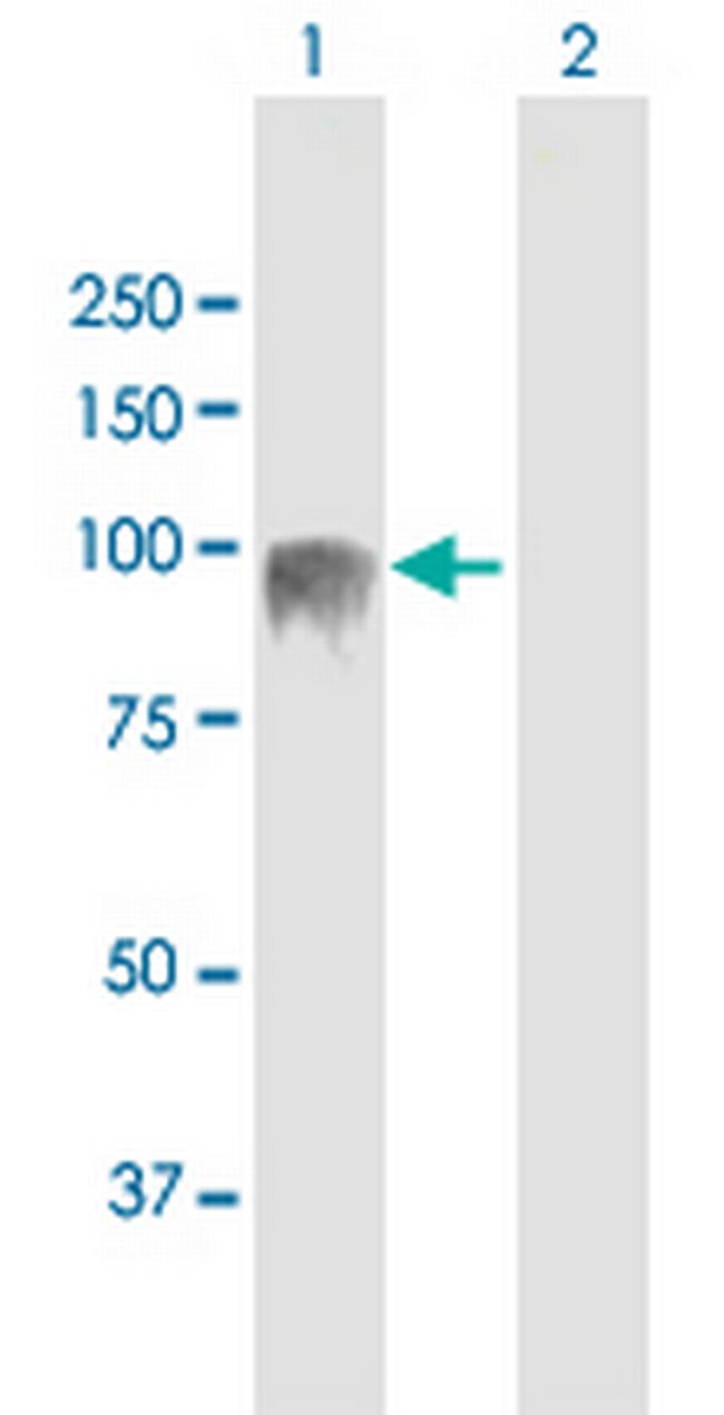 EVI5L Antibody in Western Blot (WB)
