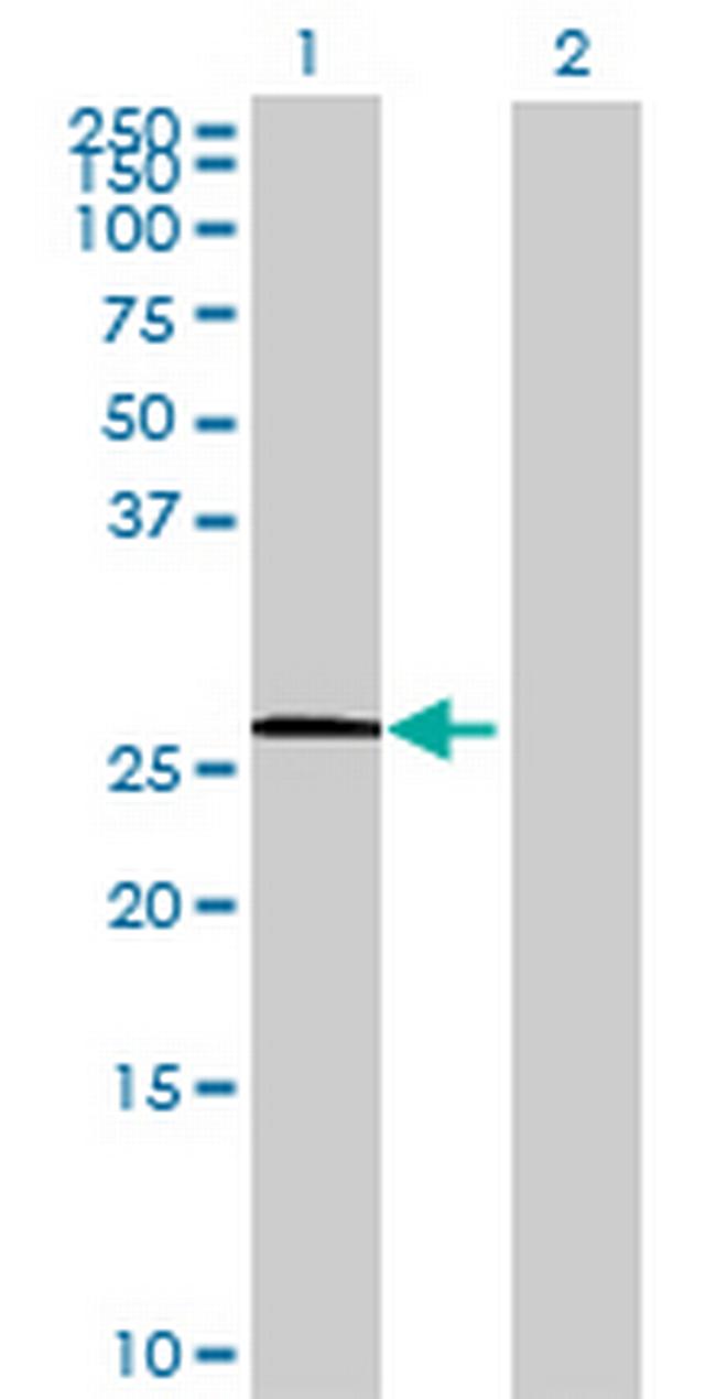 C14orf172 Antibody in Western Blot (WB)