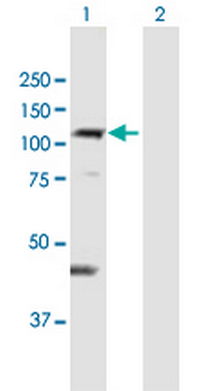 MGC4562 Antibody in Western Blot (WB)