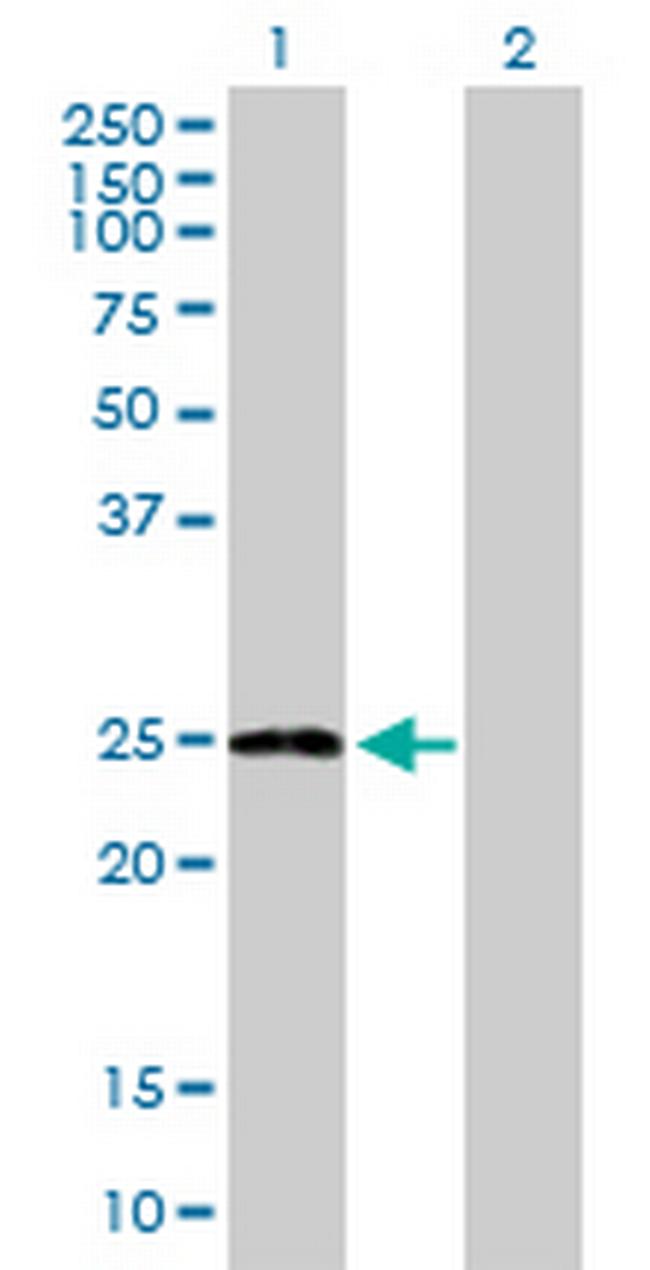 ARL11 Antibody in Western Blot (WB)