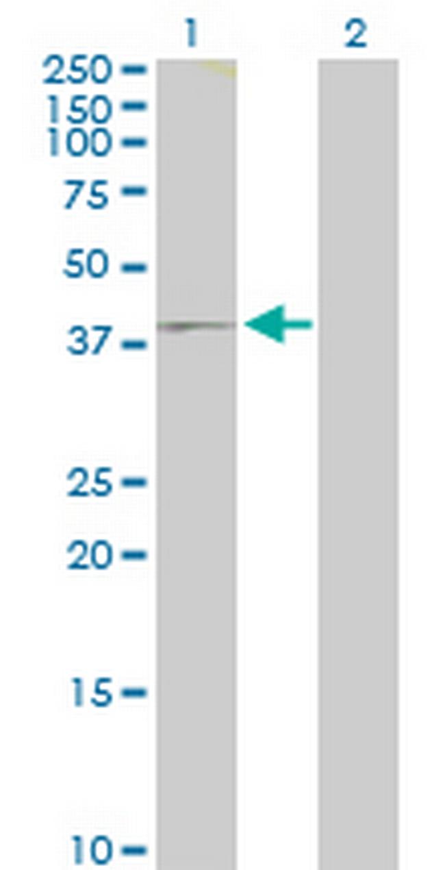 IQCD Antibody in Western Blot (WB)