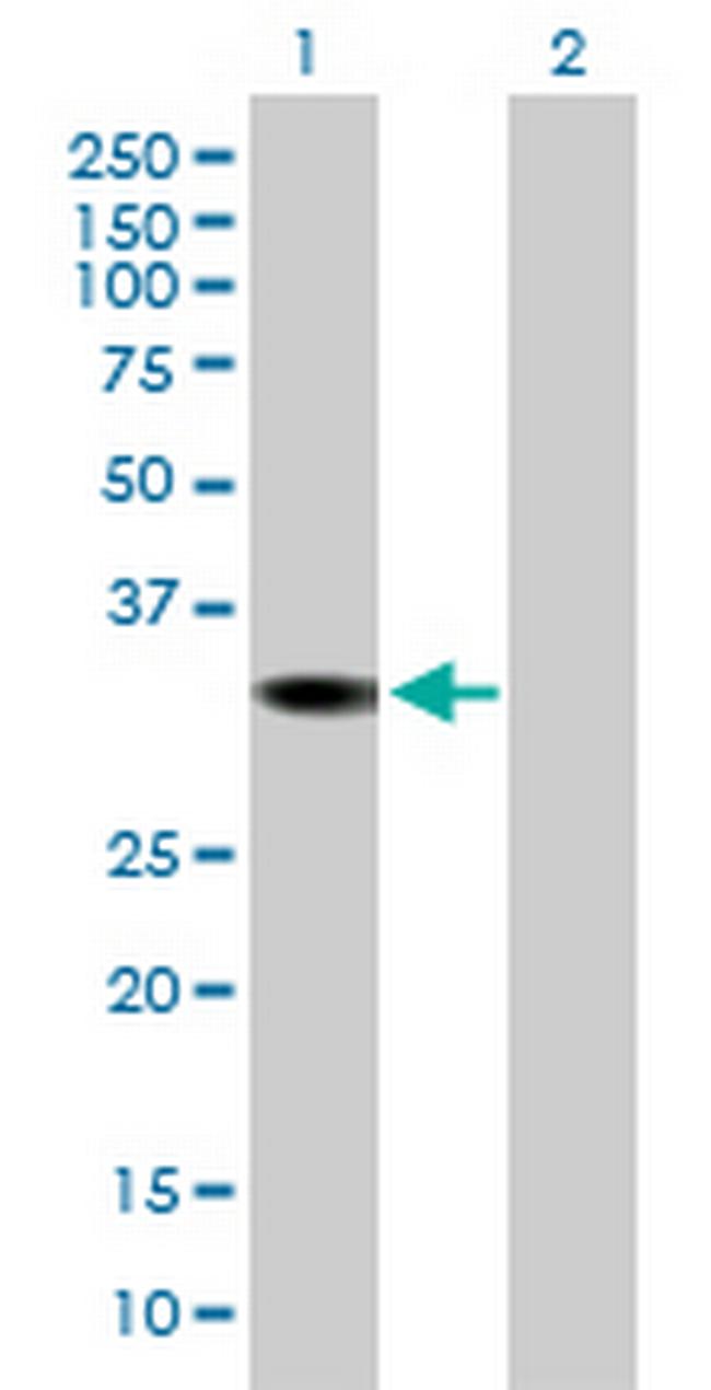 DHRS1 Antibody in Western Blot (WB)