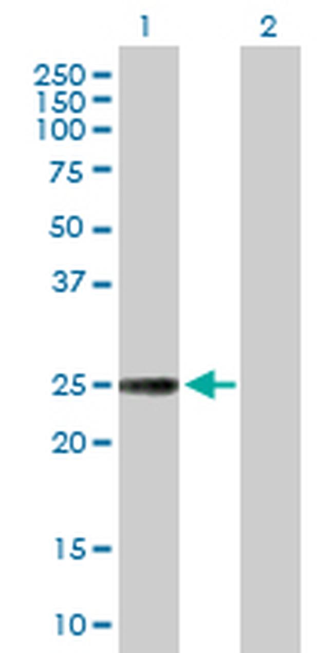 NXNL1 Antibody in Western Blot (WB)