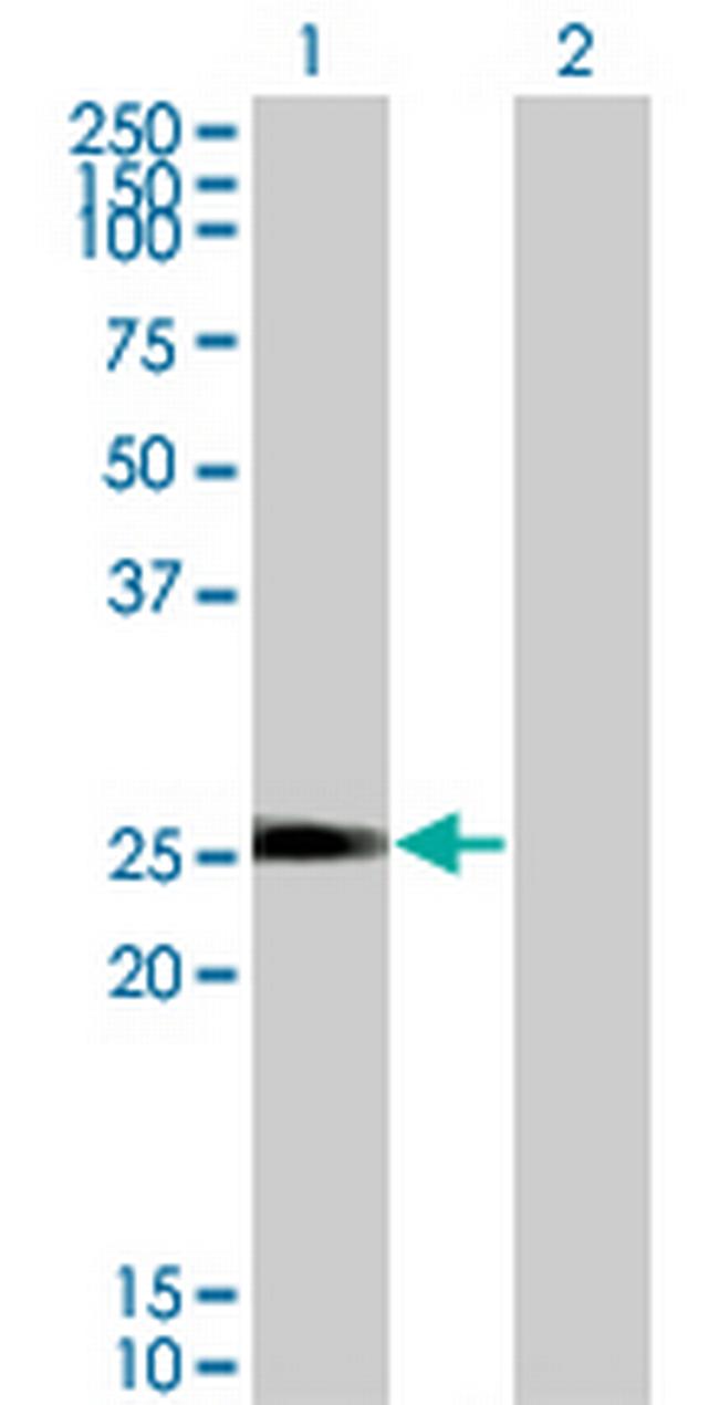 NXNL1 Antibody in Western Blot (WB)