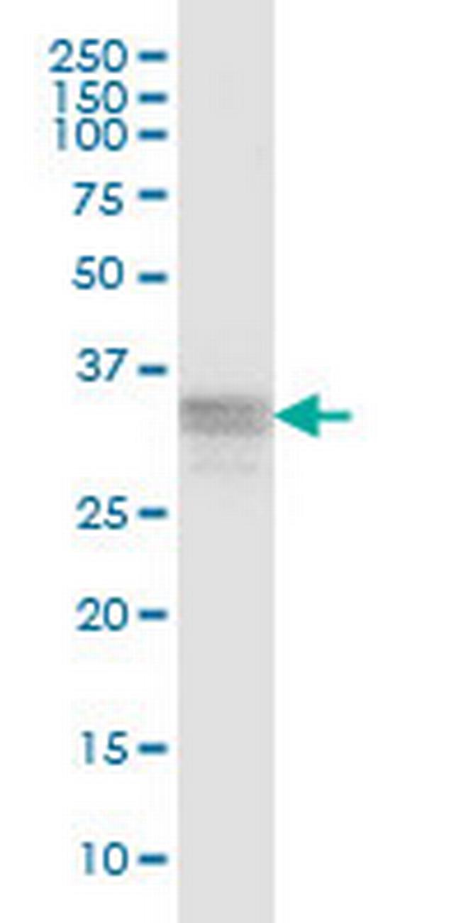 RNF166 Antibody in Western Blot (WB)