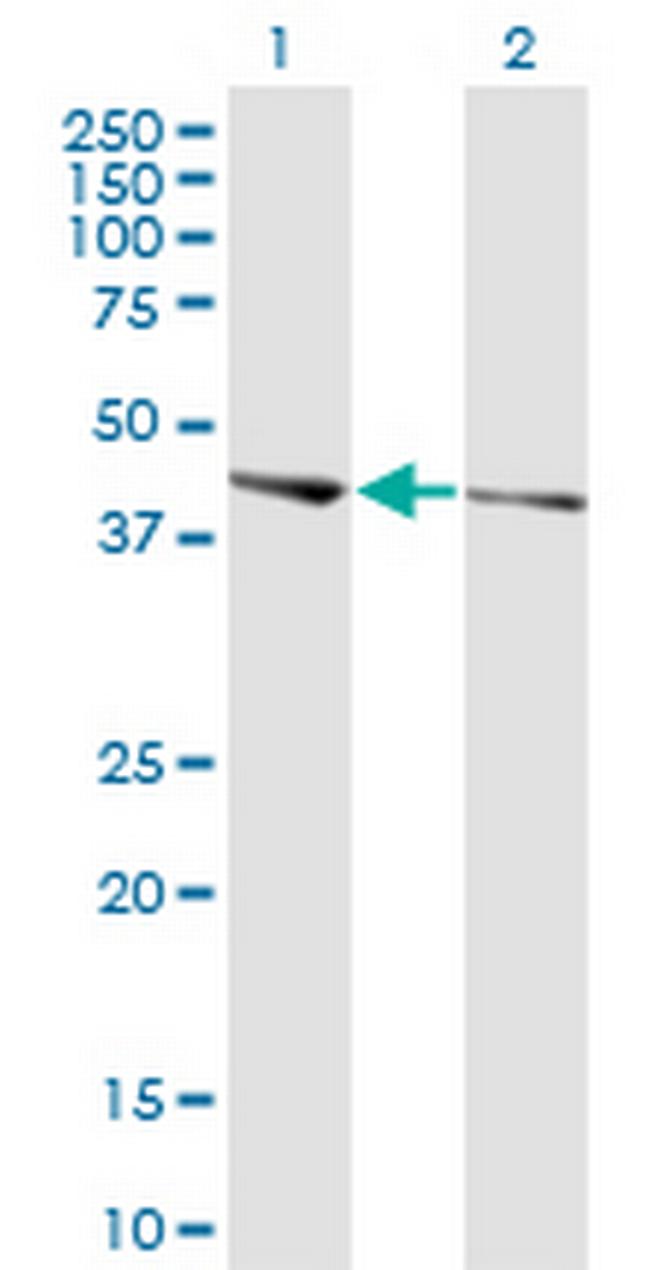 PHACTR3 Antibody in Western Blot (WB)