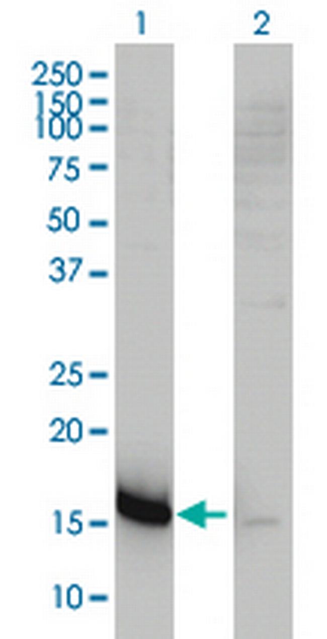 CKLFSF5 Antibody in Western Blot (WB)