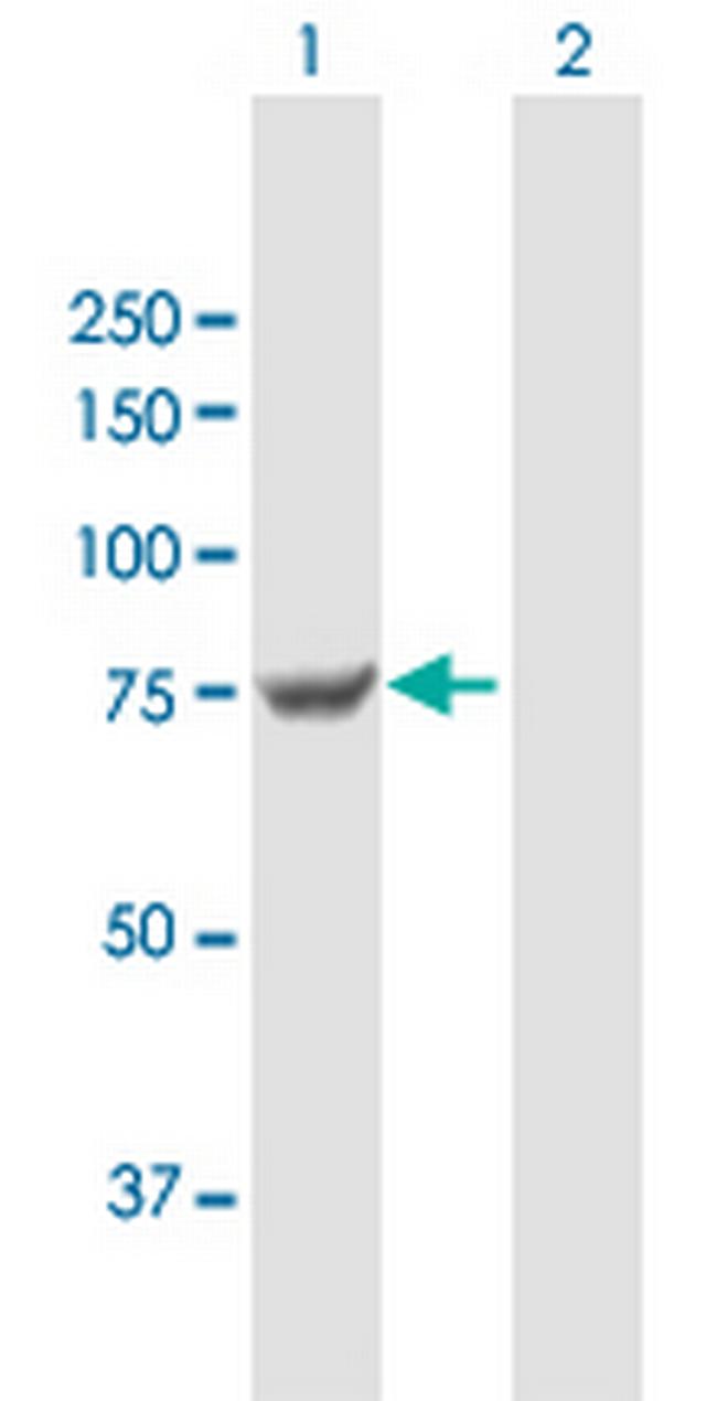 TGM7 Antibody in Western Blot (WB)