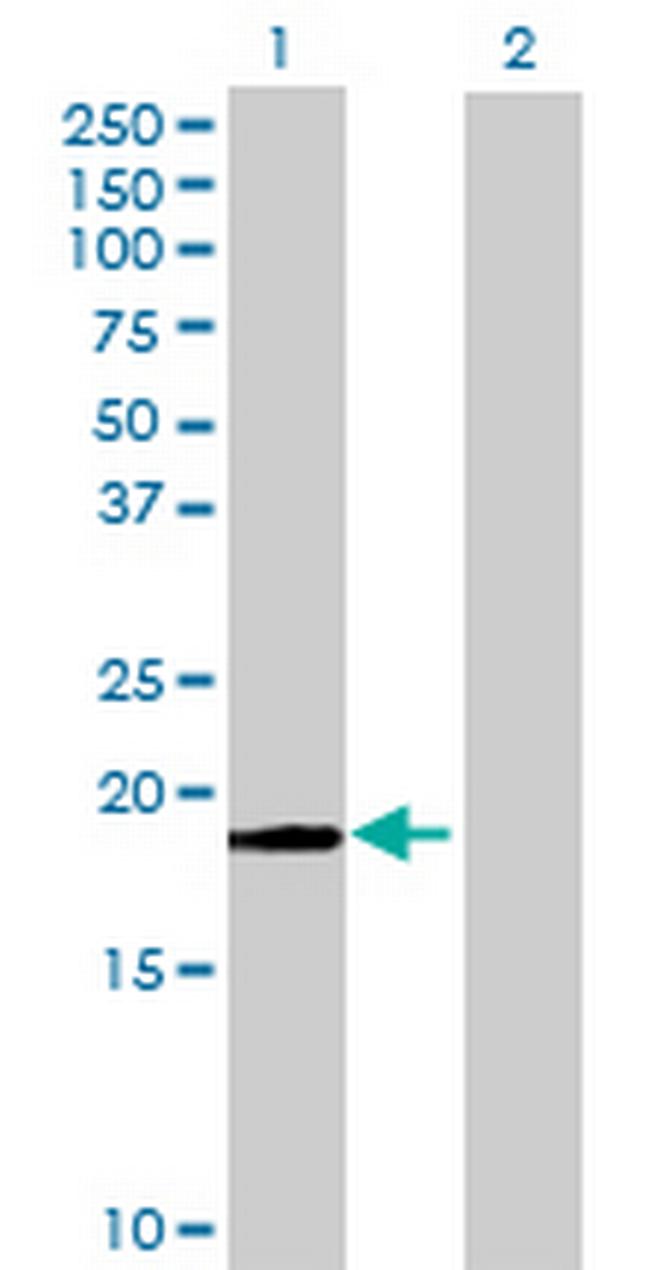 C1orf19 Antibody in Western Blot (WB)