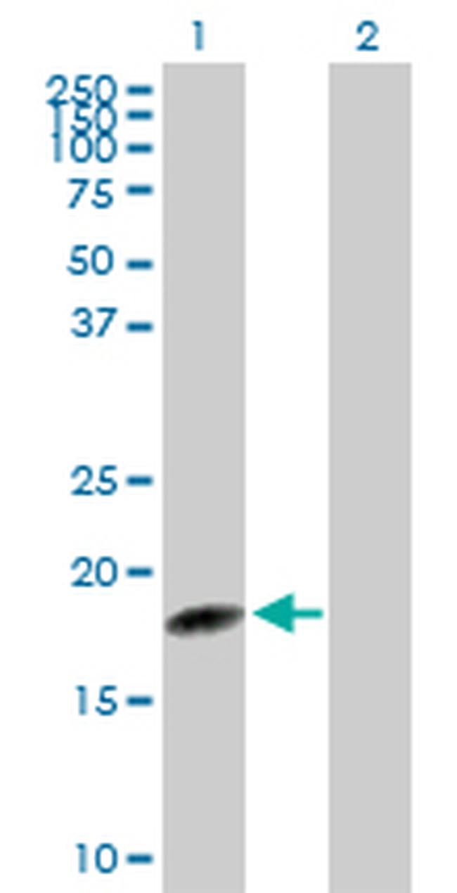 C1ORF19 Antibody in Western Blot (WB)