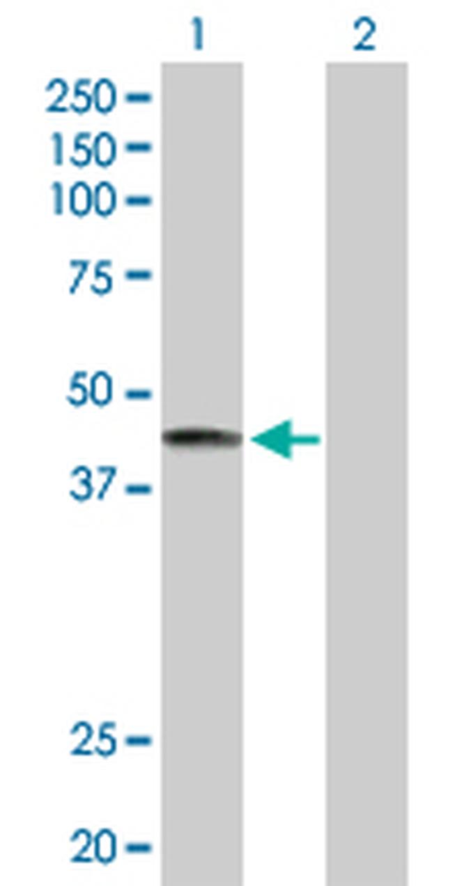 LRG1 Antibody in Western Blot (WB)