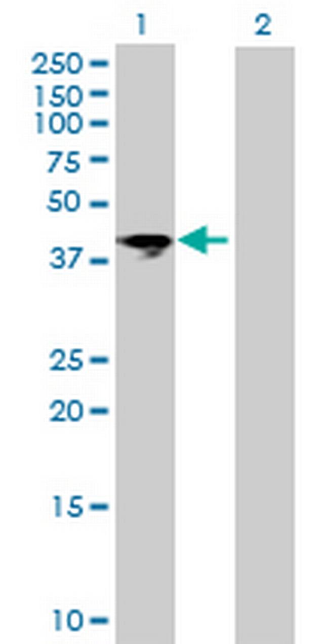 ART5 Antibody in Western Blot (WB)