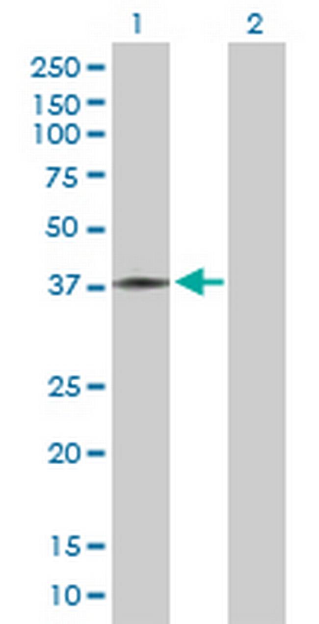 ART5 Antibody in Western Blot (WB)