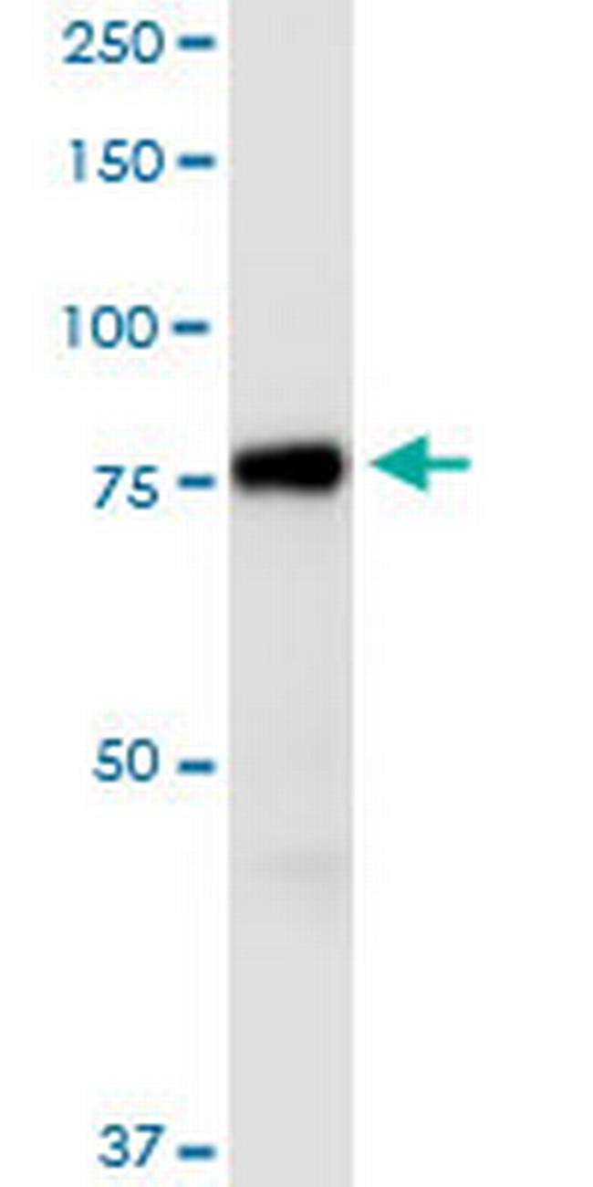 AGAP1 Antibody in Western Blot (WB)