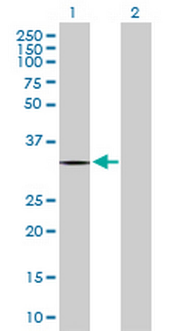 ZNF511 Antibody in Western Blot (WB)