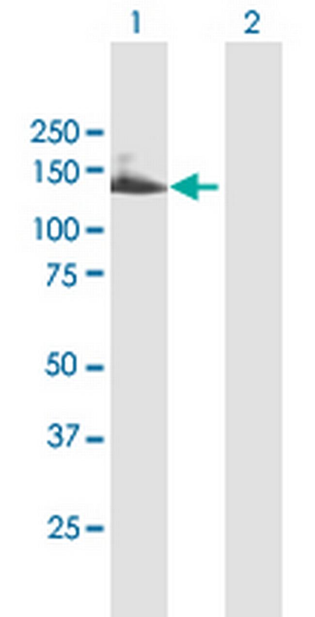 TTC18 Antibody in Western Blot (WB)