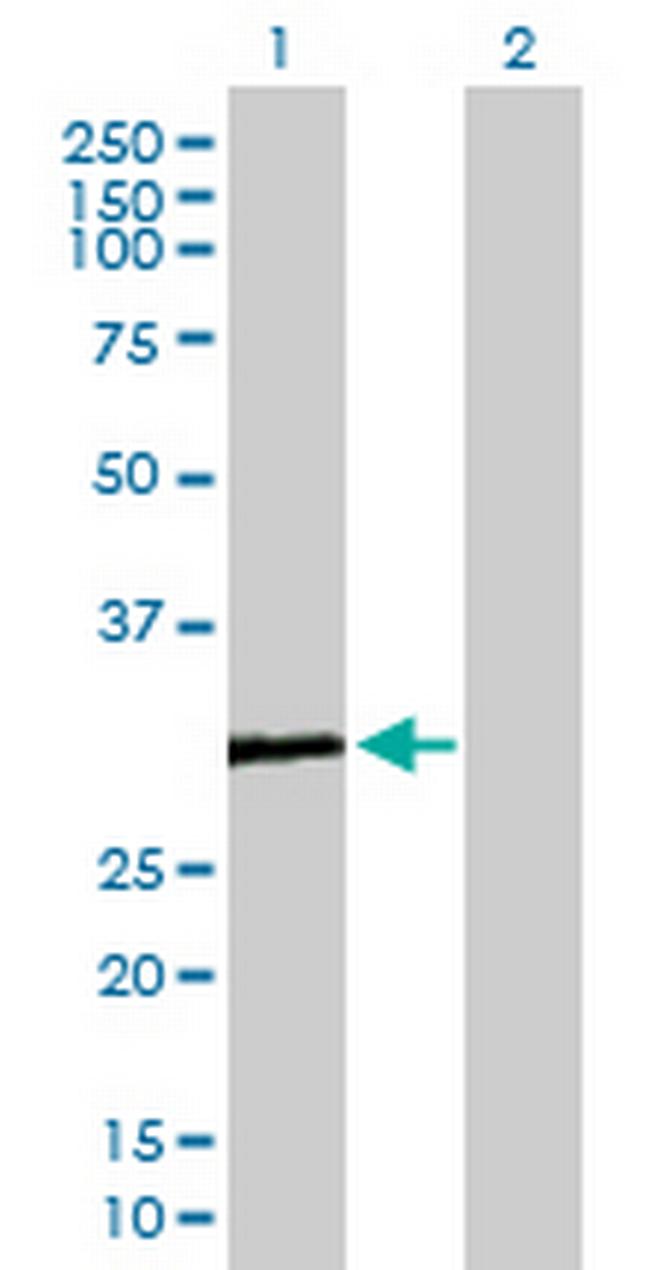 COMTD1 Antibody in Western Blot (WB)