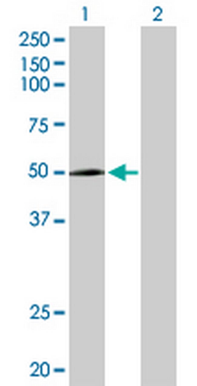 CYP2R1 Antibody in Western Blot (WB)