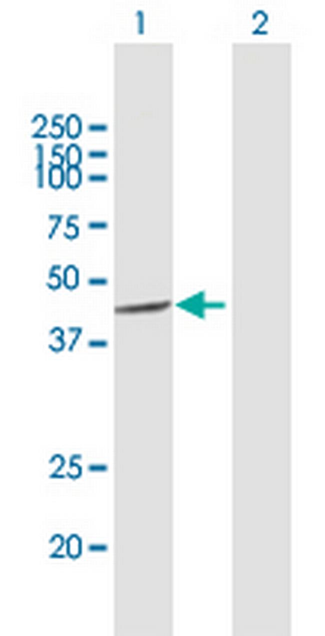 CSNK1A1L Antibody in Western Blot (WB)