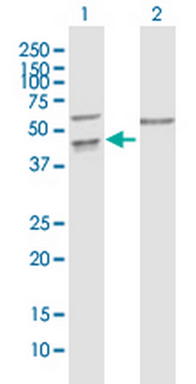 PPIL5 Antibody in Western Blot (WB)