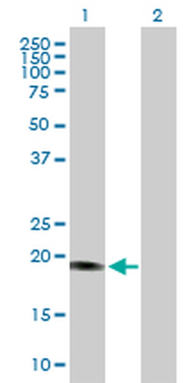 SENP8 Antibody in Western Blot (WB)