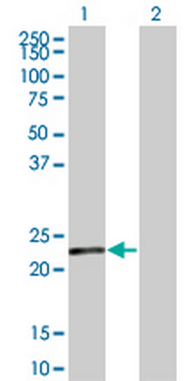 SENP8 Antibody in Western Blot (WB)