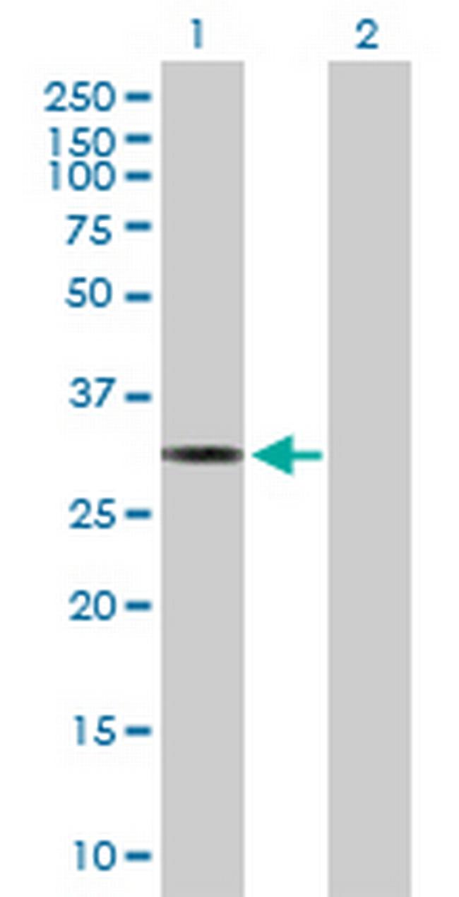 MTFMT Antibody in Western Blot (WB)