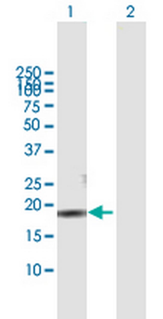 CMTM3 Antibody in Western Blot (WB)