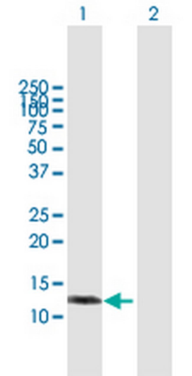 MGC52282 Antibody in Western Blot (WB)