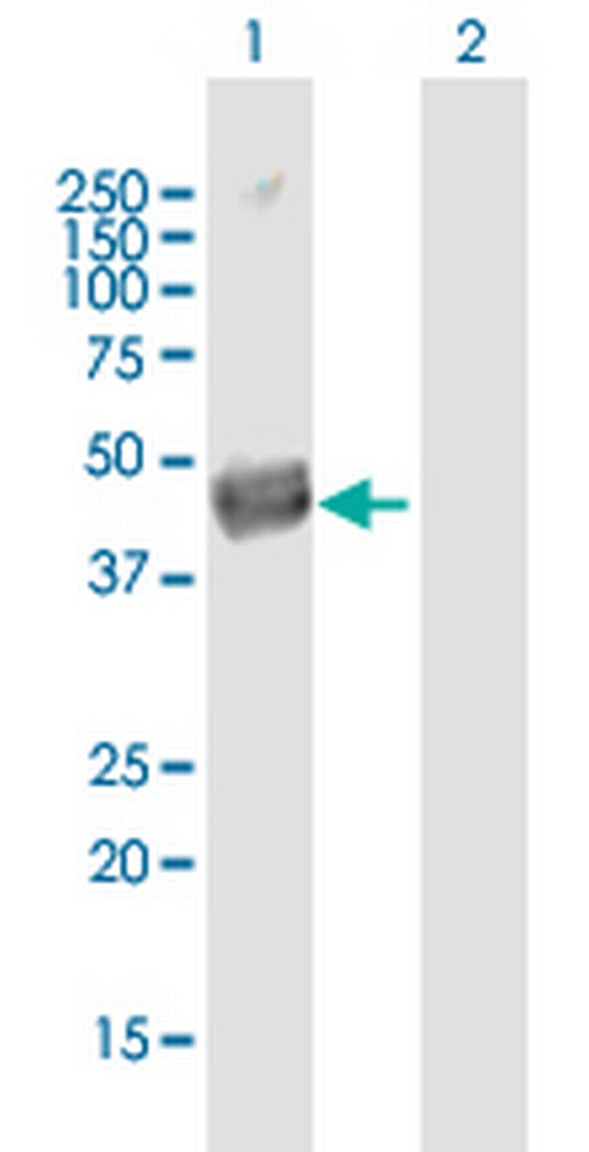 SEPT12 Antibody in Western Blot (WB)