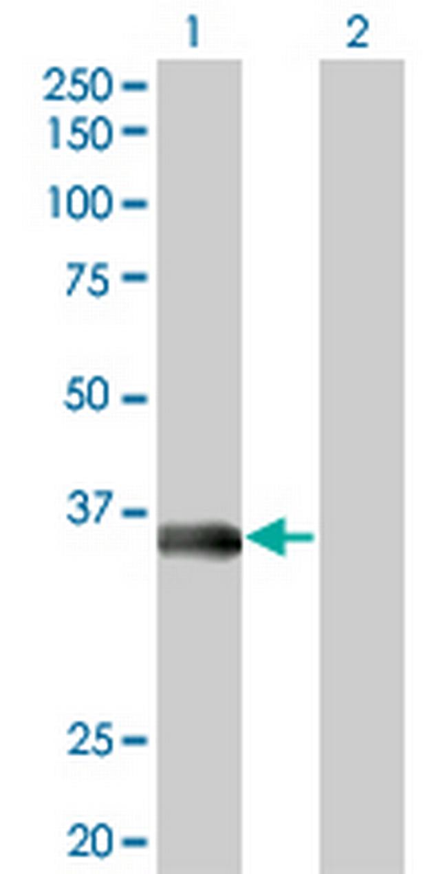 MSI2 Antibody in Western Blot (WB)