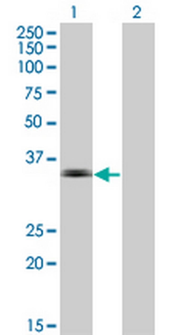 MSI2 Antibody in Western Blot (WB)