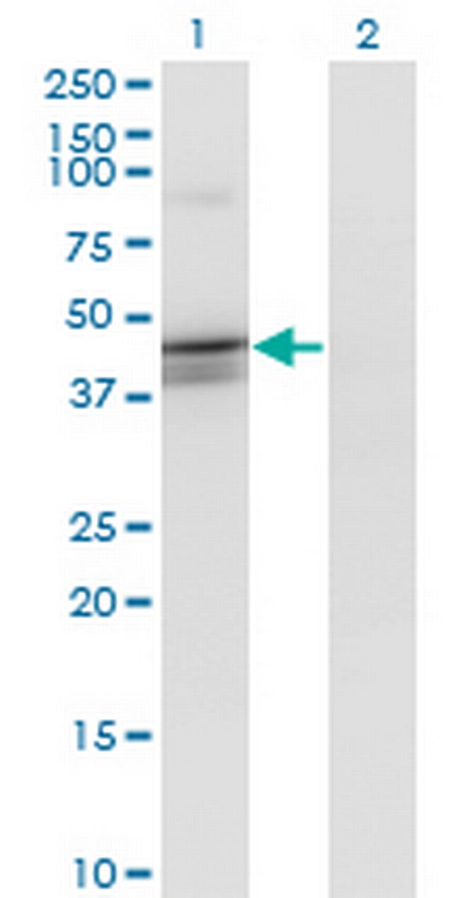 CANT1 Antibody in Western Blot (WB)