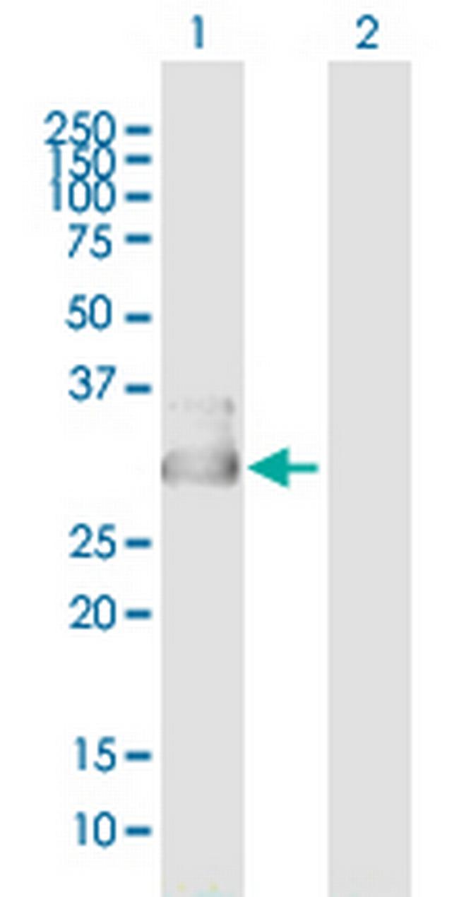 CYB5D1 Antibody in Western Blot (WB)