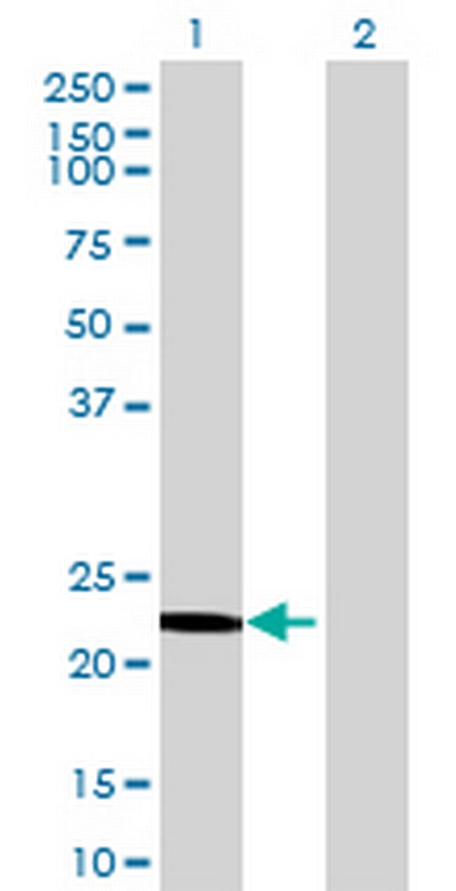 OVCA2 Antibody in Western Blot (WB)