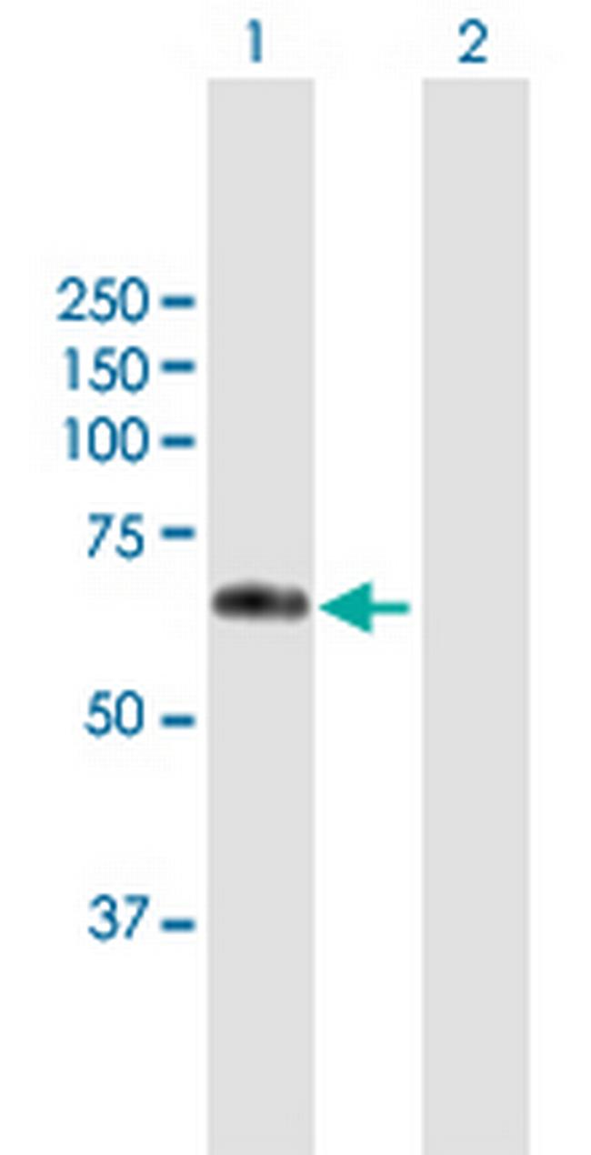 WFIKKN2 Antibody in Western Blot (WB)