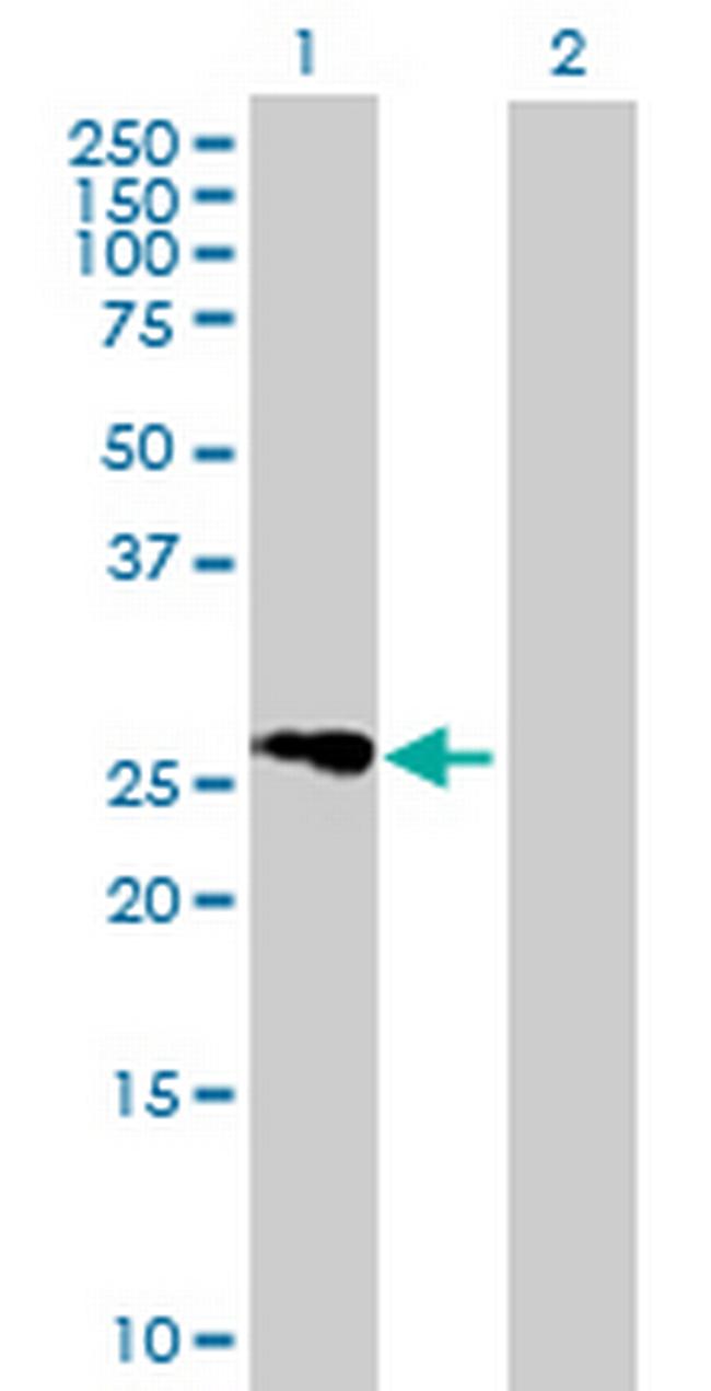 FLJ25006 Antibody in Western Blot (WB)