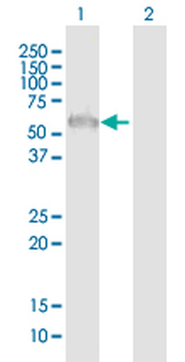 ZFP3 Antibody in Western Blot (WB)