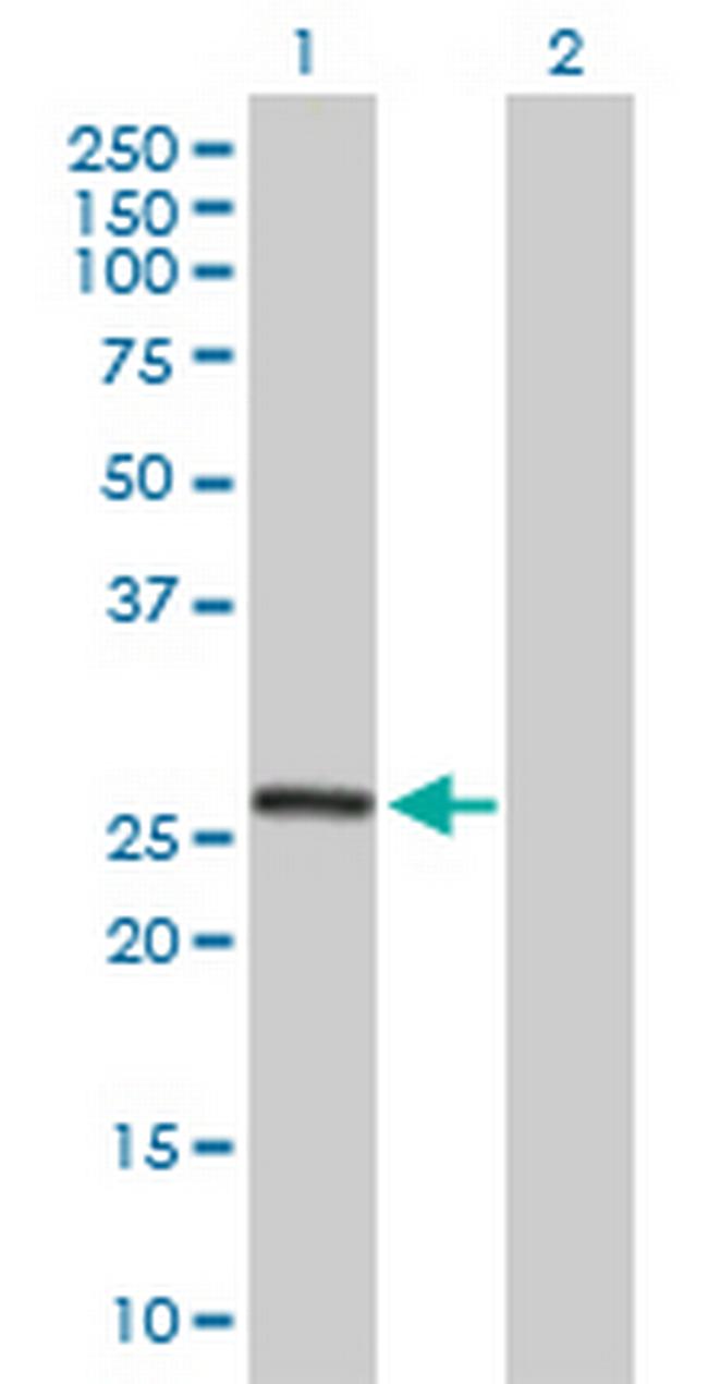 MRPL10 Antibody in Western Blot (WB)