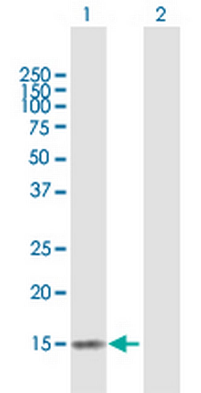 MGC33839 Antibody in Western Blot (WB)