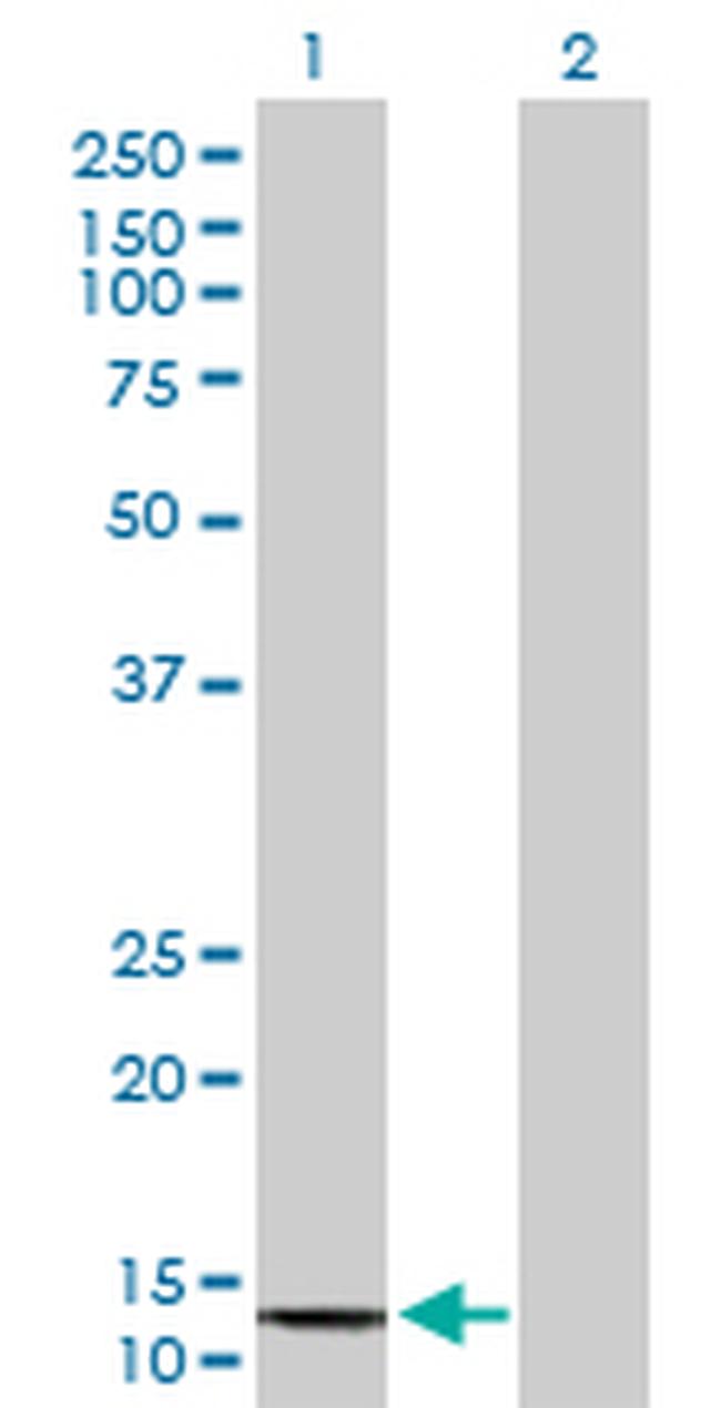 COX6B2 Antibody in Western Blot (WB)