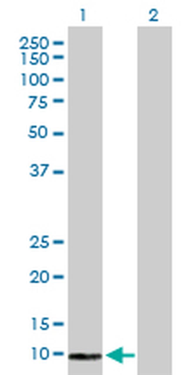 COX6B2 Antibody in Western Blot (WB)